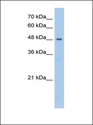 Anti-PNPLA5 (AB2) antibody produced in rabbit