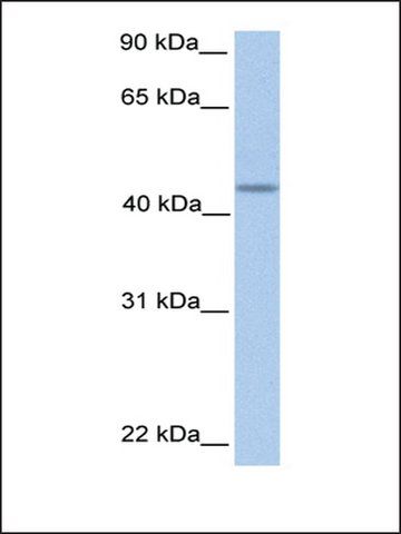 Anti-PNPLA5 (AB1) antibody produced in rabbit