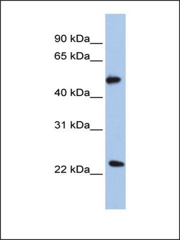 Anti-POFUT2 (AB1) antibody produced in rabbit