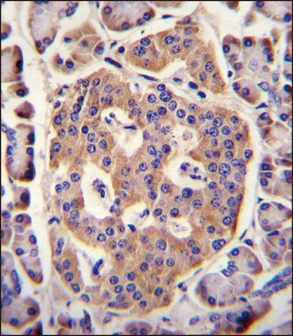 ANTI-PLD5 (C-TERM) antibody produced in rabbit