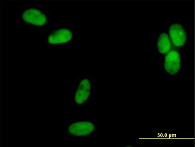 Anti-POLD2 antibody produced in mouse