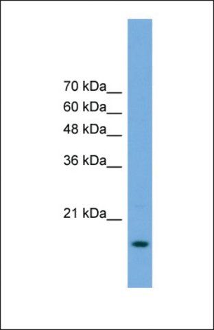 Anti-POP5 antibody produced in rabbit