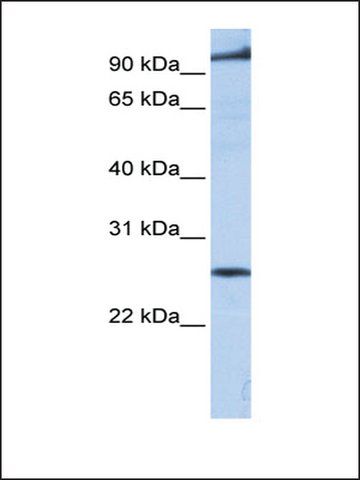 Anti-PPAPDC1B antibody produced in rabbit