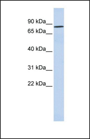 Anti-POU6F2, (N-terminal) antibody produced in rabbit