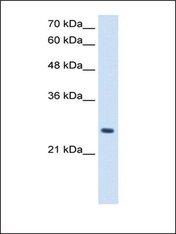 Anti-PPCDC antibody produced in rabbit