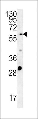 ANTI-POTEB (C-TERM) antibody produced in rabbit