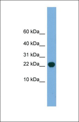 Anti-POP5 antibody produced in rabbit