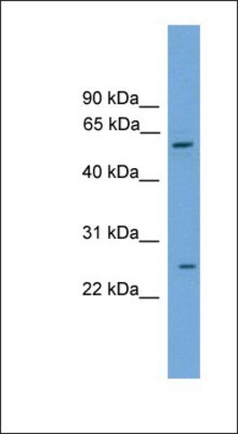 Anti-POT1 antibody produced in rabbit