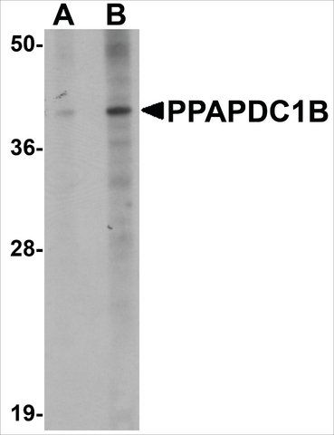 Anti-PPAPDC1B antibody produced in rabbit