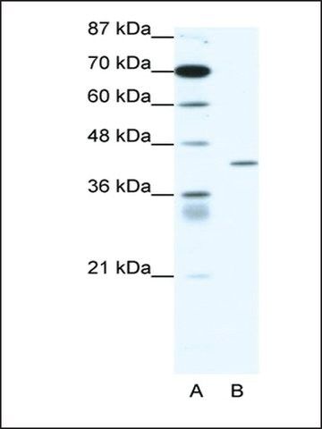 Anti-PPARD antibody produced in rabbit