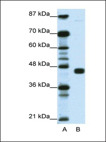 Anti-PPARG antibody produced in rabbit