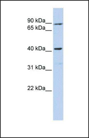 Anti-PPID antibody produced in rabbit