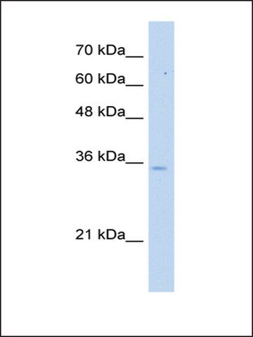 Anti-PPA1 antibody produced in rabbit