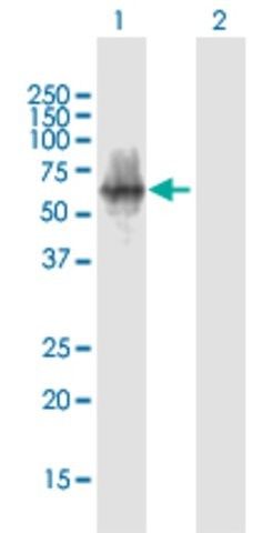 Anti-POTEA antibody produced in mouse