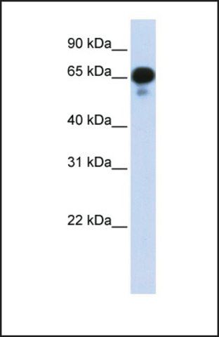 Anti-PPM1J, (N-terminal) antibody produced in rabbit