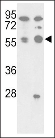 ANTI-PP5 (PP5C)(C-TERMINAL) antibody produced in rabbit