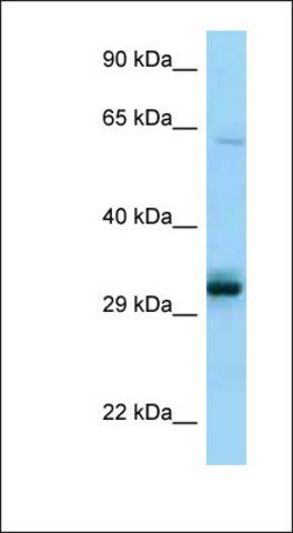 Anti-PPCS antibody produced in rabbit