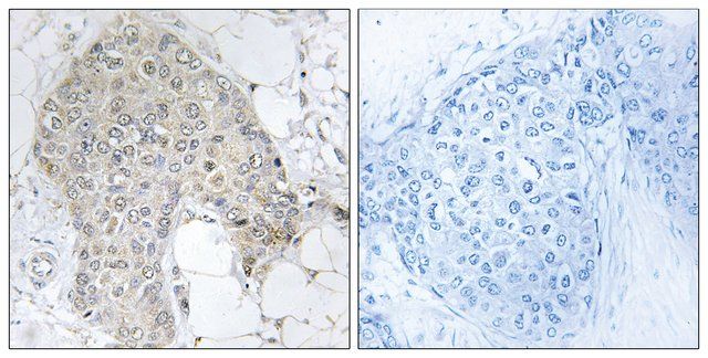 Anti-PPP1R2 antibody produced in rabbit