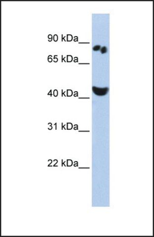 Anti-POU6F2, (N-terminal) antibody produced in rabbit