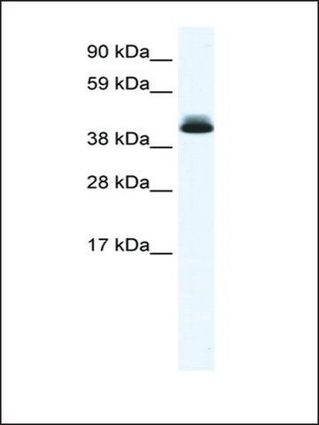 Anti-PPARD (AB3) antibody produced in rabbit