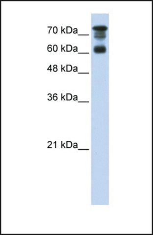 Anti-PPP1R13L, (C-terminal) antibody produced in rabbit