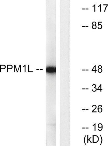 Anti-PPM1L antibody produced in rabbit