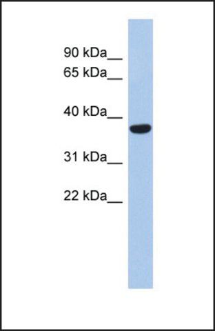 Anti-PPAPDC2, (N-terminal) antibody produced in rabbit