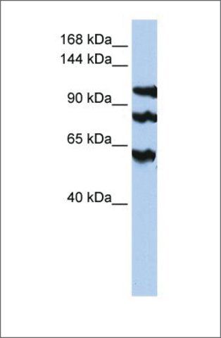 Anti-PPP1R13B antibody produced in rabbit