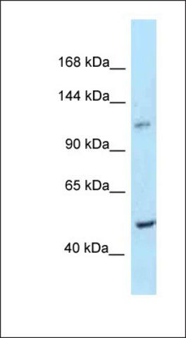 Anti-PPIP5K2 antibody produced in rabbit