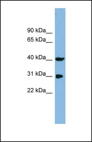 Anti-PPID, (N-terminal) antibody produced in rabbit