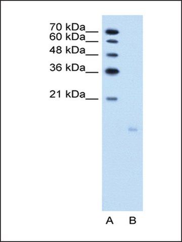 Anti-PPFIBP1 antibody produced in rabbit