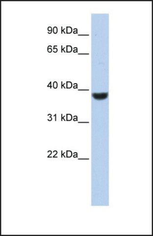 Anti-PPP1CA, (N-terminal) antibody produced in rabbit