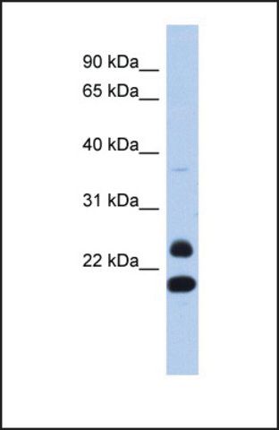 Anti-NEUROG2, (N-terminal) antibody produced in rabbit