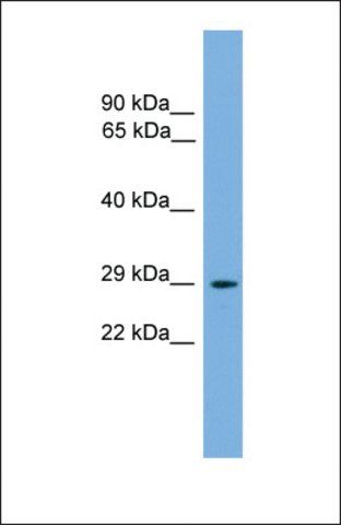 Anti-NRIP2, (N-terminal) antibody produced in rabbit