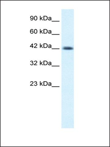 Anti-NSEP1 (AB2) antibody produced in rabbit