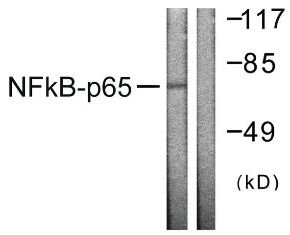 Anti-NF-B p65 antibody produced in rabbit