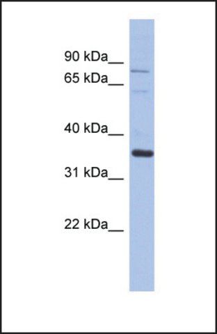 Anti-NRBP2 antibody produced in rabbit