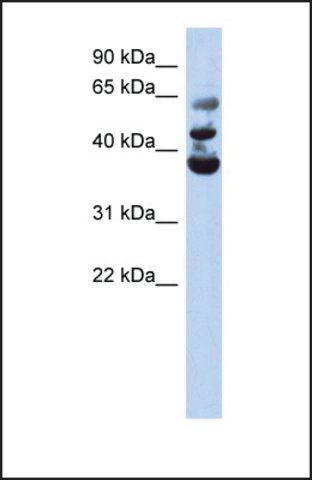 Anti-NSUN3 antibody produced in rabbit