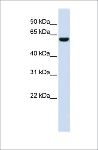 Anti-NRG1