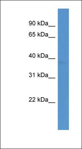 Anti-NT5C1A antibody produced in rabbit