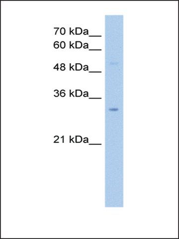 Anti-NSUN5C antibody produced in rabbit