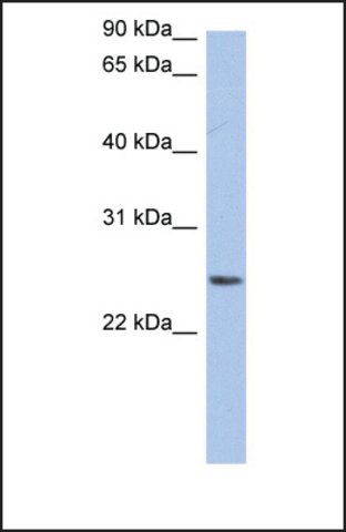 Anti-NRSN2 antibody produced in rabbit