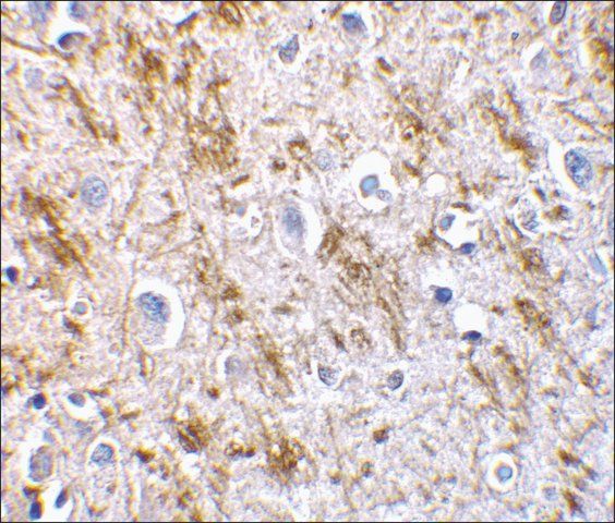 Anti-Neurturin antibody produced in rabbit