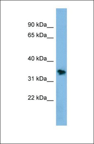 Anti-NSMCE1 antibody produced in rabbit