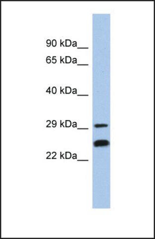 Anti-NSMCE2 antibody produced in rabbit