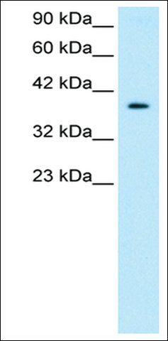 Anti-NT5C3 antibody produced in rabbit