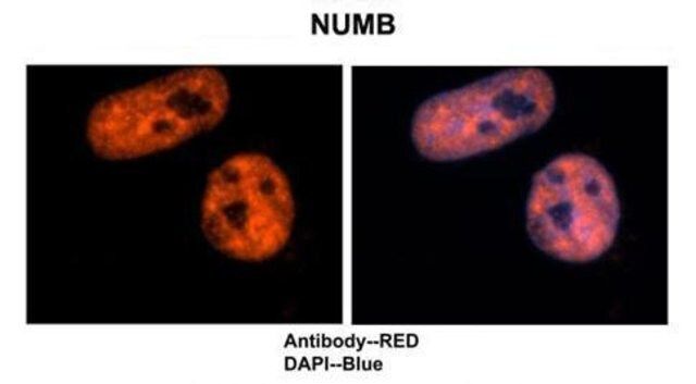 Anti-NUMB antibody produced in rabbit