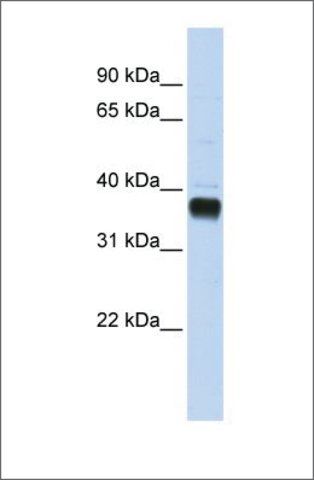 Anti-NUDT18 (ab2) antibody produced in rabbit