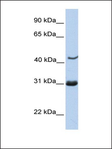 Anti-NUP35 (AB2) antibody produced in rabbit