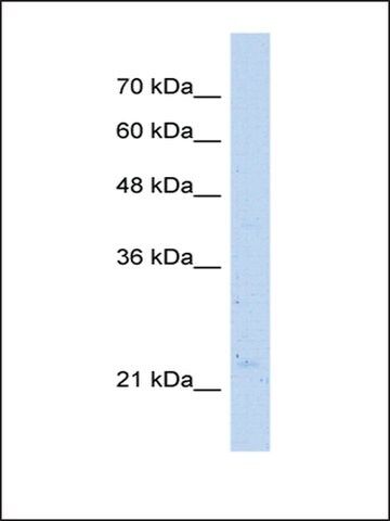 Anti-NUDT16L1